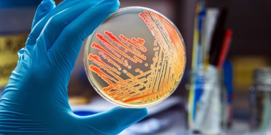 Bioburden, ¿análisis necesario en la industria manufacturera de dispositivos médicos?