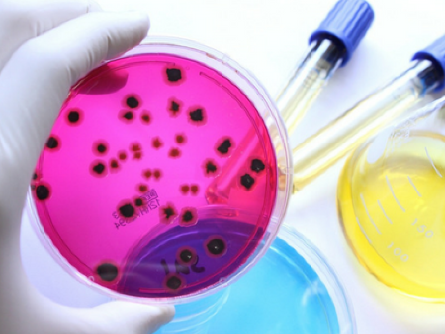 El bioburden de los productos sanitarios