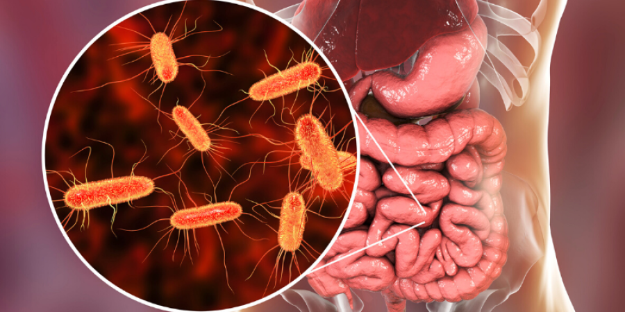 ¿Cómo afecta la Escherichia coli en la salud humana?